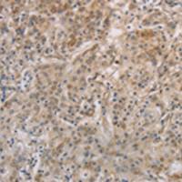 兔抗ESRRG多克隆抗体