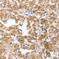 兔抗CIAPIN1多克隆抗体