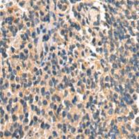 兔抗XYLT1多克隆抗体