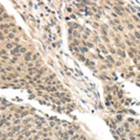 兔抗BRCA2多克隆抗体