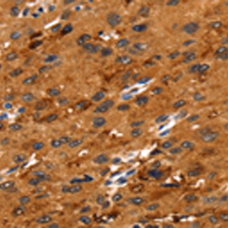 兔抗FGFR3多克隆抗体