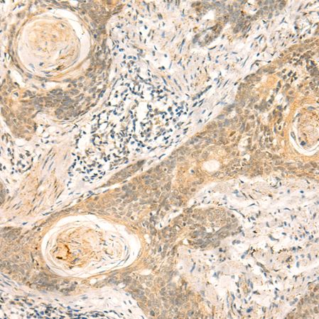 兔抗NIP7多克隆抗体