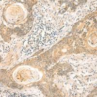 兔抗NIP7多克隆抗体