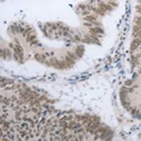 兔抗AKAP8多克隆抗体