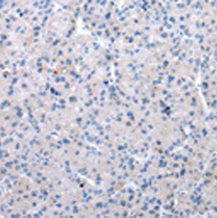 兔抗XKR6多克隆抗体