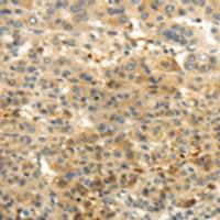 兔抗CAMK1G多克隆抗体