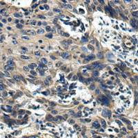 兔抗S1PR2多克隆抗体