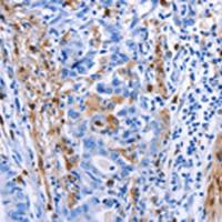 兔抗PTGS1多克隆抗体