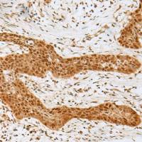 兔抗GOLGA7多克隆抗体