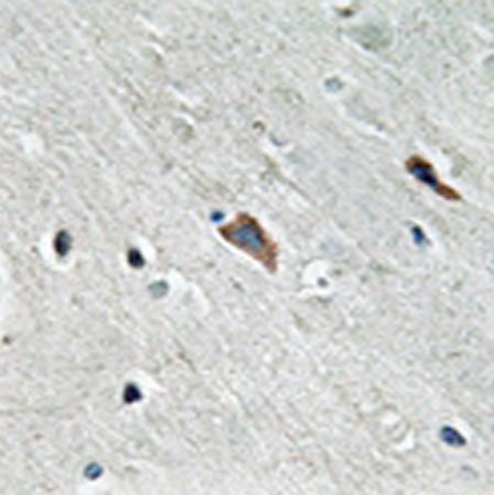 兔抗GAB2(Phospho-Tyr643) 多克隆抗体