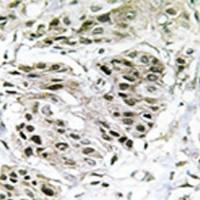 兔抗CENPA多克隆抗体