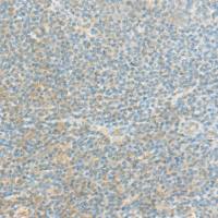 兔抗FAM171A2多克隆抗体