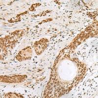 兔抗PNRC2多克隆抗体