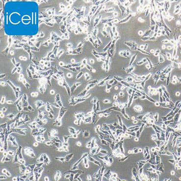 UM-UC-3 人膀胱移行细胞癌细胞/STR鉴定/镜像绮点（Cellverse）