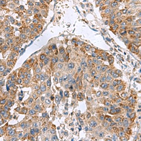 兔抗NFS1多克隆抗体