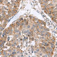 兔抗NFS1多克隆抗体