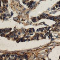 兔抗TTLL10多克隆抗体