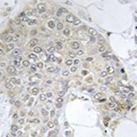 兔抗PPP1R2(Ab-120121)多克隆抗体