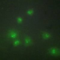 兔抗ZRANB2多克隆抗体