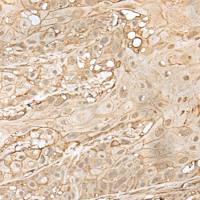 兔抗ZNF213多克隆抗体