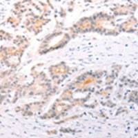 兔抗TRAF3IP1多克隆抗体