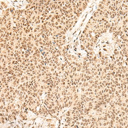 兔抗FBXL4多克隆抗体