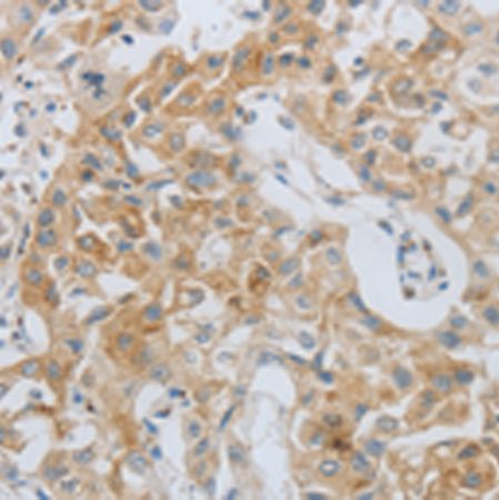 兔抗MMP25多克隆抗体