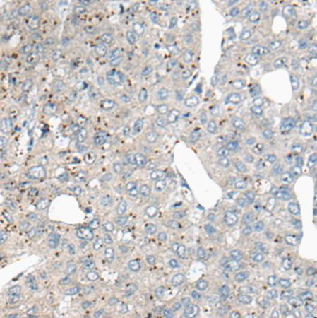 兔抗ATG2A多克隆抗体