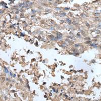 兔抗UBOX5多克隆抗体