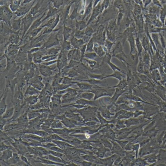 猪主动脉内皮细胞永生化/真皮毛乳头细胞/NK细胞