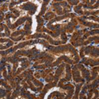 兔抗TICAM2多克隆抗体