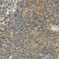 兔抗CALCA多克隆抗体