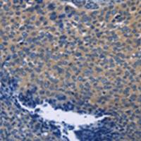 兔抗SYT17多克隆抗体