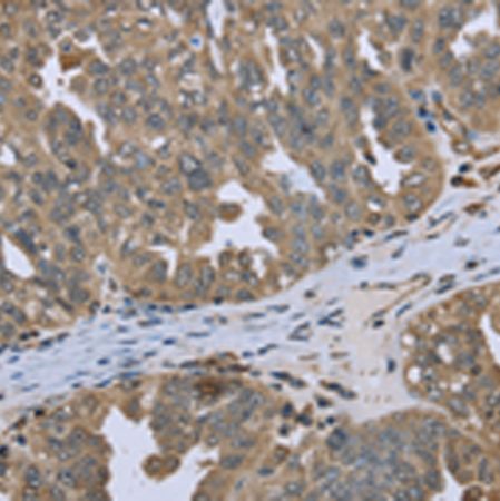 兔抗DCTN4多克隆抗体