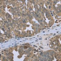 兔抗DCTN4多克隆抗体