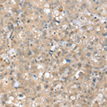 兔抗SETD3多克隆抗体