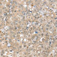 兔抗SETD3多克隆抗体