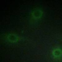 兔抗NCF1(Ab-304) 多克隆抗体