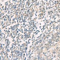 兔抗SERPINB4多克隆抗体