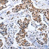 兔抗DOK3多克隆抗体