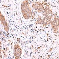 兔抗RUSC1多克隆抗体