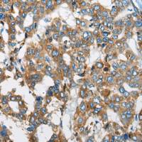 兔抗ZC2HC1A多克隆抗体