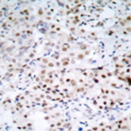 兔抗CREB1(Ab-129/133) 多克隆抗体