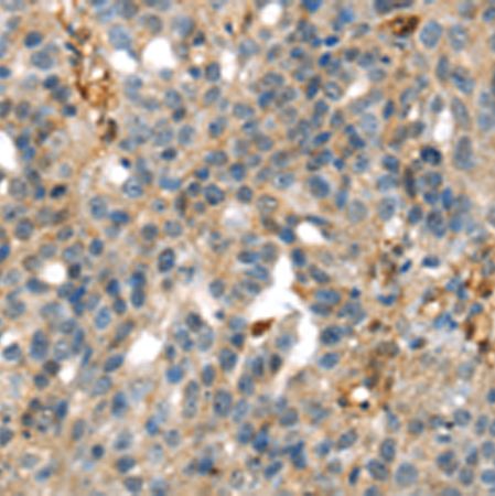 兔抗SERPINB6多克隆抗体