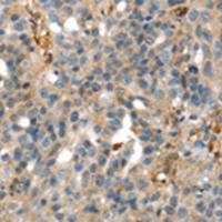 兔抗SERPINB6多克隆抗体