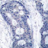 兔抗EIF4E 多克隆抗体