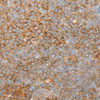 兔抗SNX33多克隆抗体