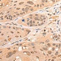 兔抗BPGM多克隆抗体