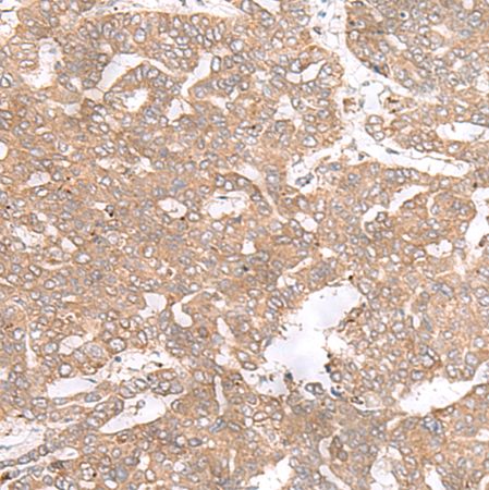 兔抗PTP4A3多克隆抗体