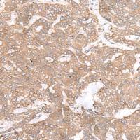 兔抗PTP4A3多克隆抗体